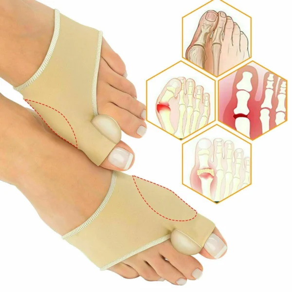 Smart Care Bunion Support Foot Mate Correction Socks Toes Separator Feet Care - Image 11