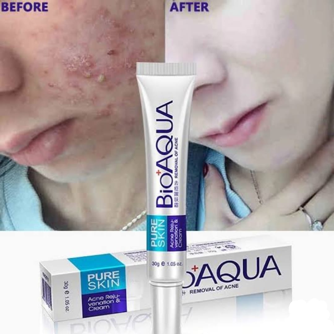 BIOAQUA Anti Acne Cream Acne Scar Removal Cream | Best Quality Scar Removal Cream 30g( Original ) - Image 2