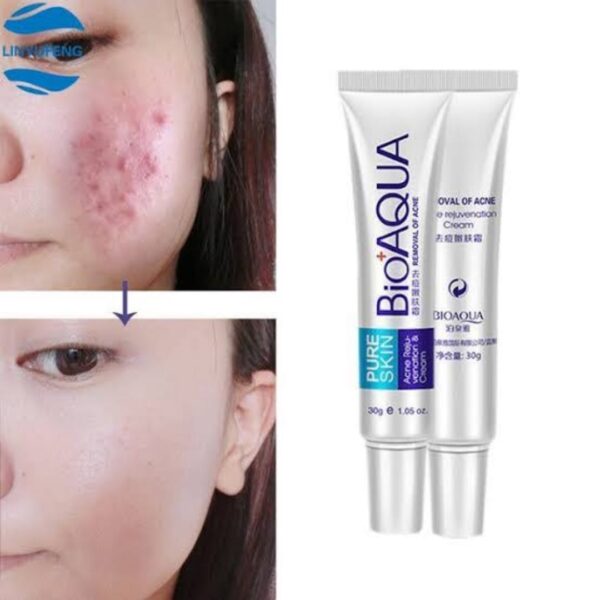 BIOAQUA Anti Acne Cream Acne Scar Removal Cream | Best Quality Scar Removal Cream 30g( Original ) - Image 3