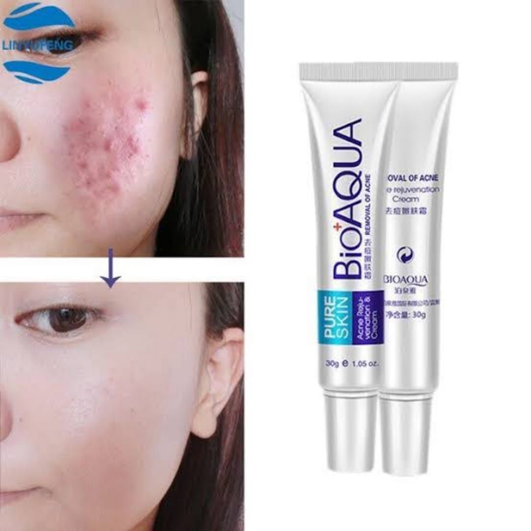 BIOAQUA Anti Acne Cream Acne Scar Removal Cream | Best Quality Scar Removal Cream 30g( Original ) - Image 3