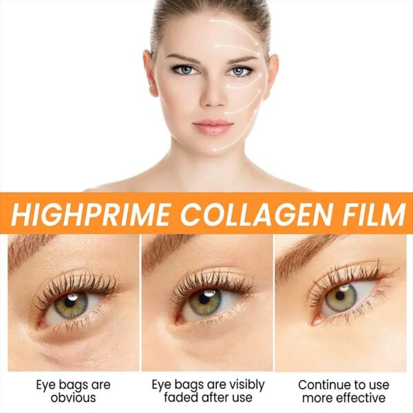10pcs / 1 Box Eyes Bag Remove Collagen Eye Patch Instant Fade Fine Lines Dark Circles Fat Particles Moisturizing Anti-puffiness Korea Eye Care - Image 5