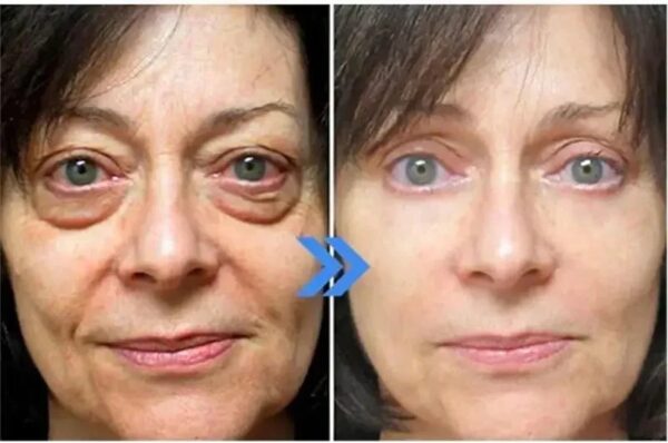 10pcs / 1 Box Eyes Bag Remove Collagen Eye Patch Instant Fade Fine Lines Dark Circles Fat Particles Moisturizing Anti-puffiness Korea Eye Care - Image 14