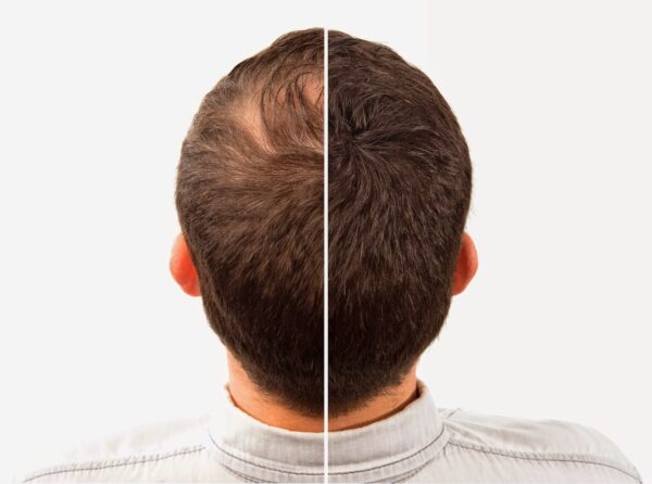 Caboki Hair Building Fibers  25g | Black | Dark Brown Hair building fibers  adds volume to thin hair - Image 6