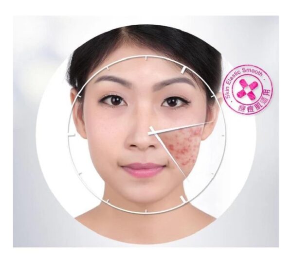 BIOAQUA Anti Acne Cream Acne Scar Removal Cream - Image 2