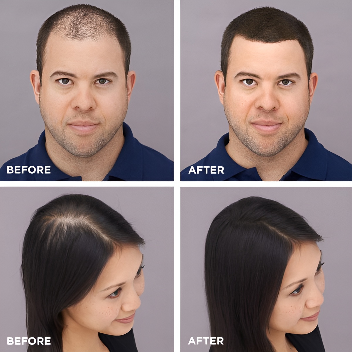 Toppik Hair Building Fiber Fuller Looking Hair for Men & Women (27.5g) - Image 9